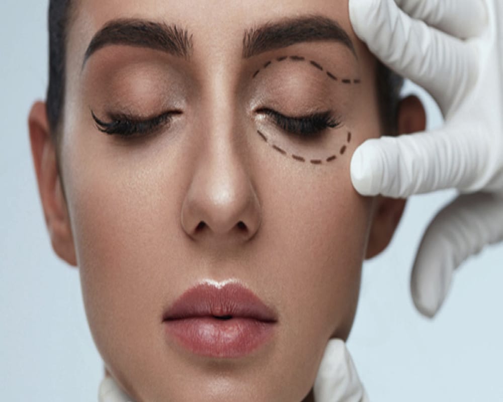 Bild der Renaissance der Blepharoplastik-Klinik für kosmetische Gesichtschirurgie