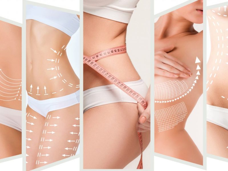 image of body cosmetic surgery renaissance clinic madrid and marbella